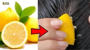 lemon home remedies