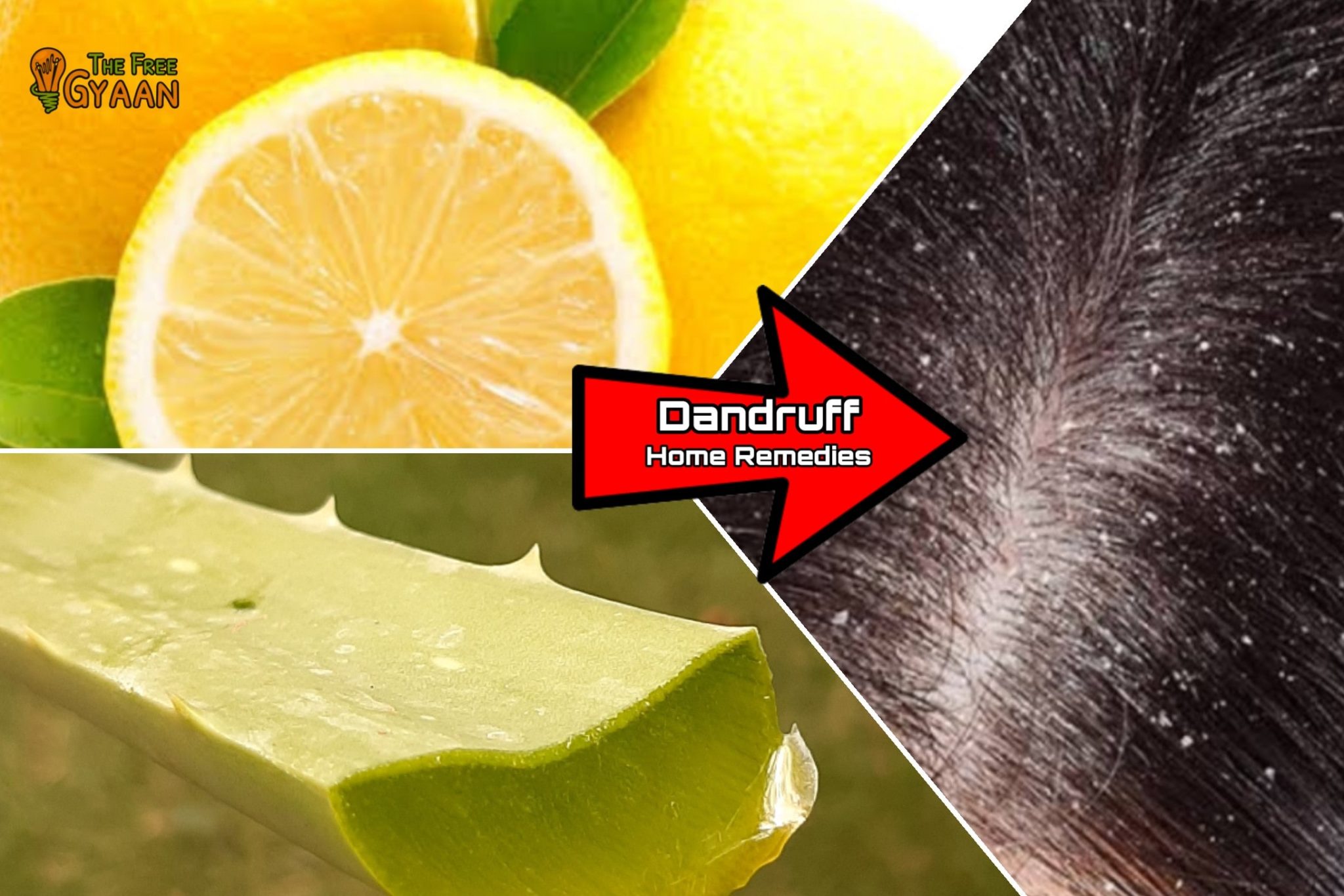 how to solve the problem of dandruff
